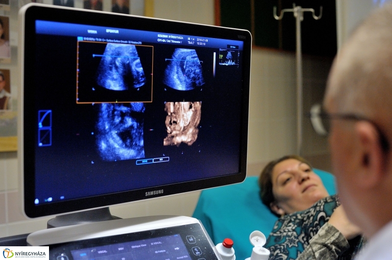 Új ultrahang készülék a Jósa András Kórházban