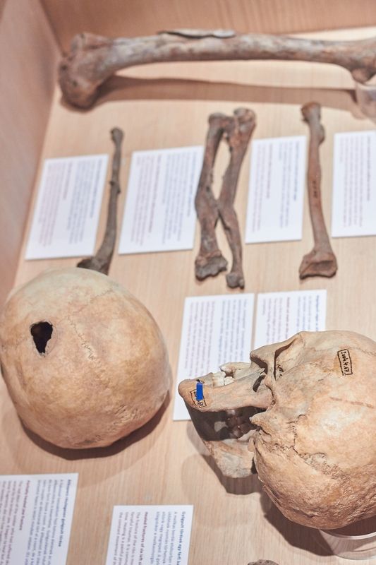 Szóra bírt csontjaink kiállítás a múzeumban