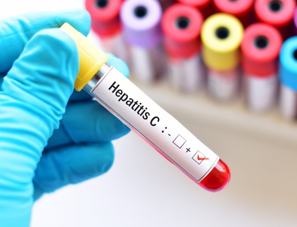 Ismét ingyenes hepatitis C szűrés országszerte – Nyíregyházán is!