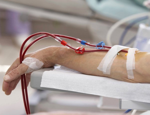 A vesebetegség néma gyilkos - Befolyásolja a betegek életminőségét