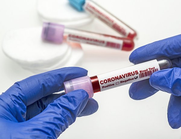 Magyarországon eddig csaknem tizennyolcezer mintát vizsgáltak meg