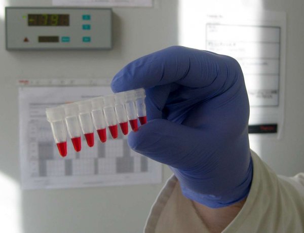 Csaknem 1,7 millió az új típusú koronavírussal fertőzöttek száma a világon