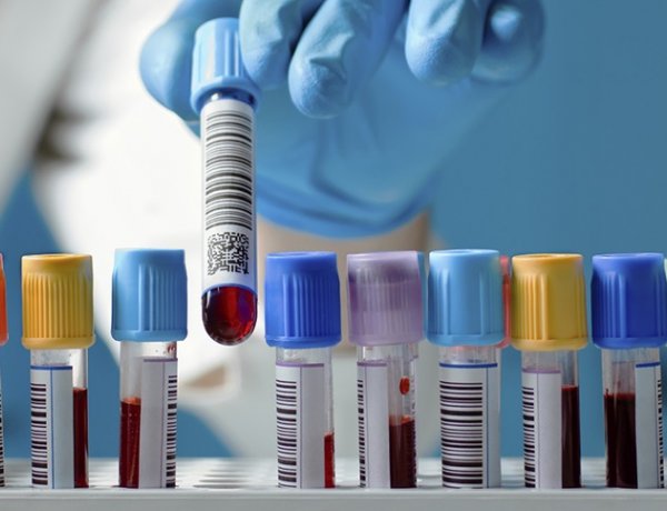 Fertőző betegségek terjedését hátráltatják a koronavírus-járvány miatti óvintézkedése