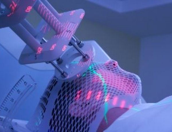 A sugárterápiát egyszerűsítő megoldáson dolgozik a Szegedi Tudományegyetem