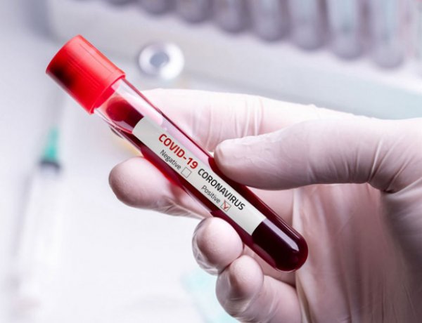 Térítés ellenében megnézik a kórházban is, hogy van-e ellenanyag a szervezetben