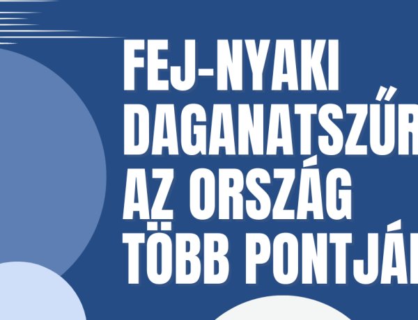 Ragadd torkon a rákot! – Idén is megszervezik a Make Sense kampányt