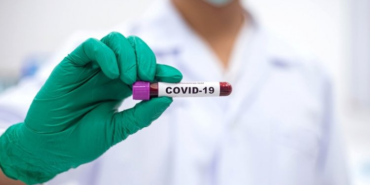 Kormányinfó: Hatósági áras lesz a koronavírus teszt, ingyenes az influenzaoltás 